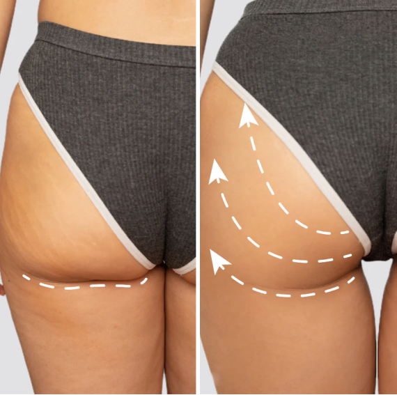 Before and after comparison