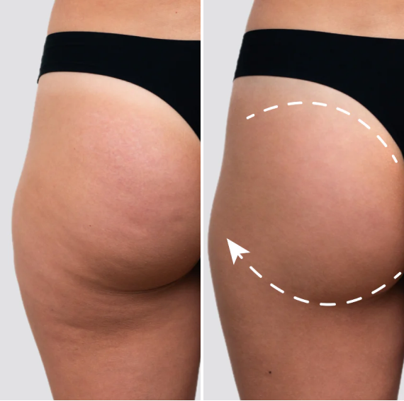 Before and after comparison