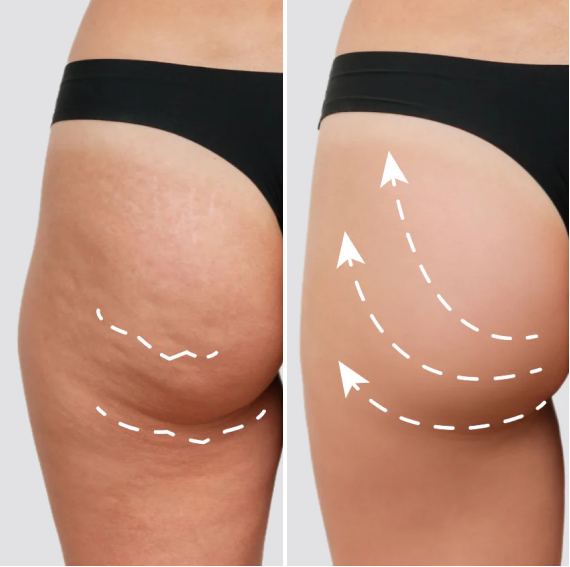 Before and after comparison