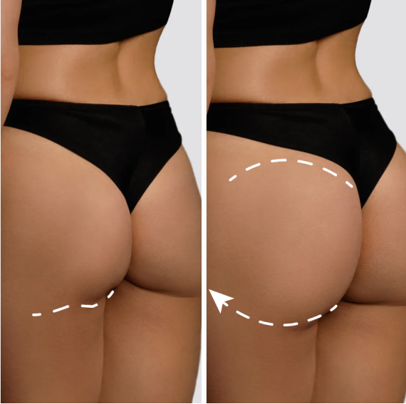 Before and after comparison