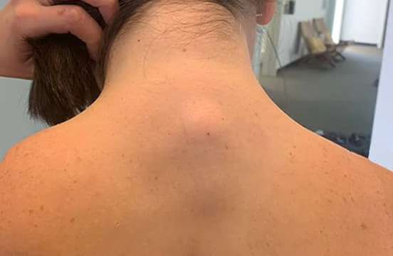 Back and neck pain relief close-up