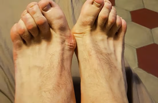 Foot pain close-up
